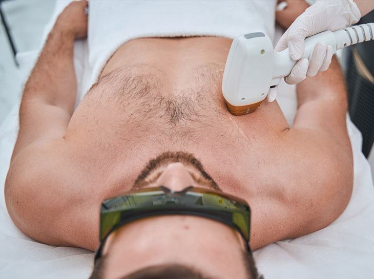 Laser Behandlung